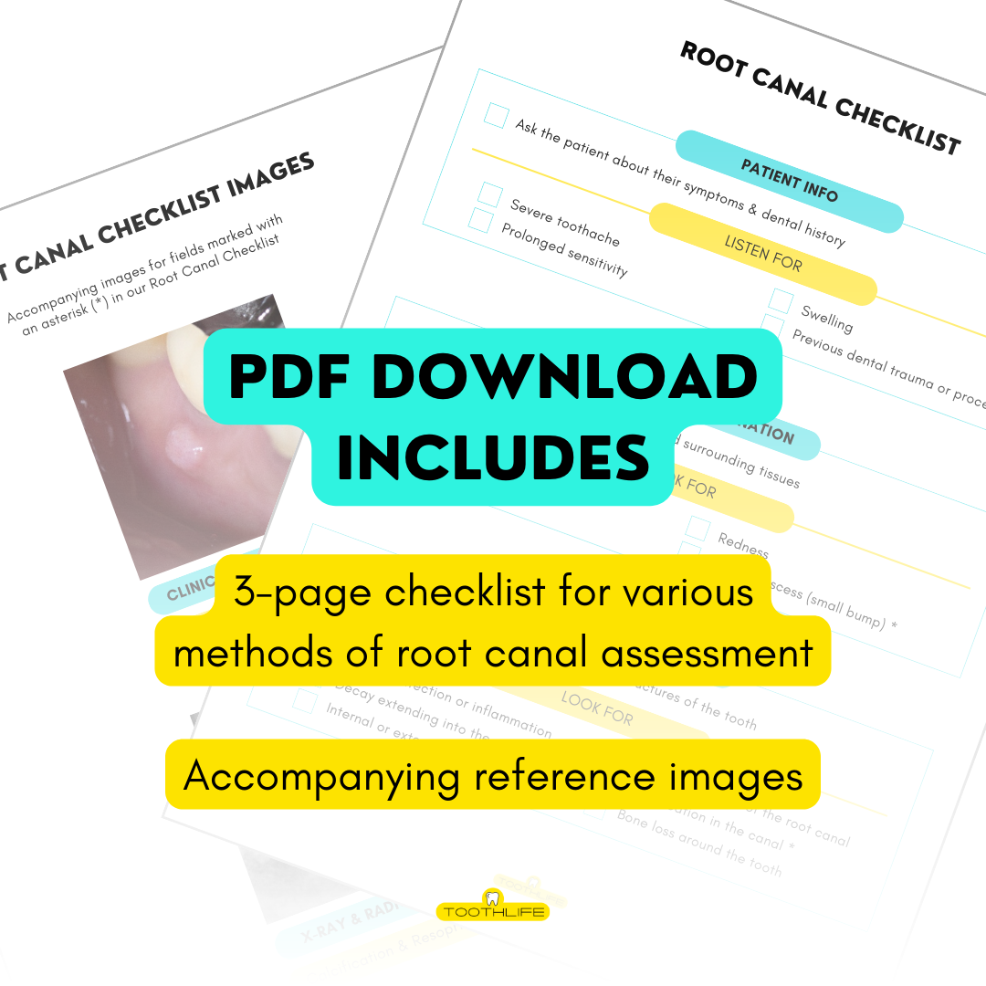 Root Canal Checklist